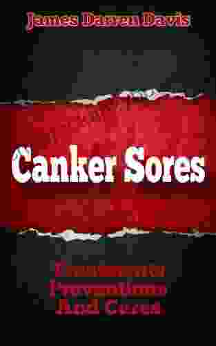 Canker Sores: Treatments Preventions And Cures