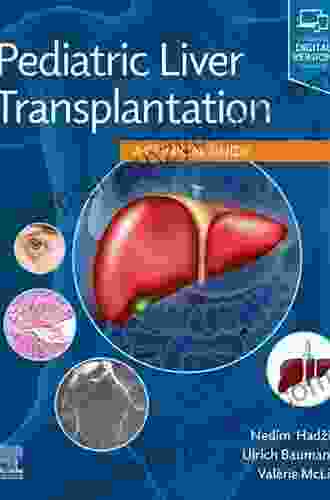 Pediatric Liver Transplantation: A Clinical Guide