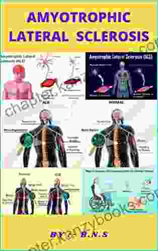 Amyotrophic Lateral Sclerosis Richard A Driscoll O D